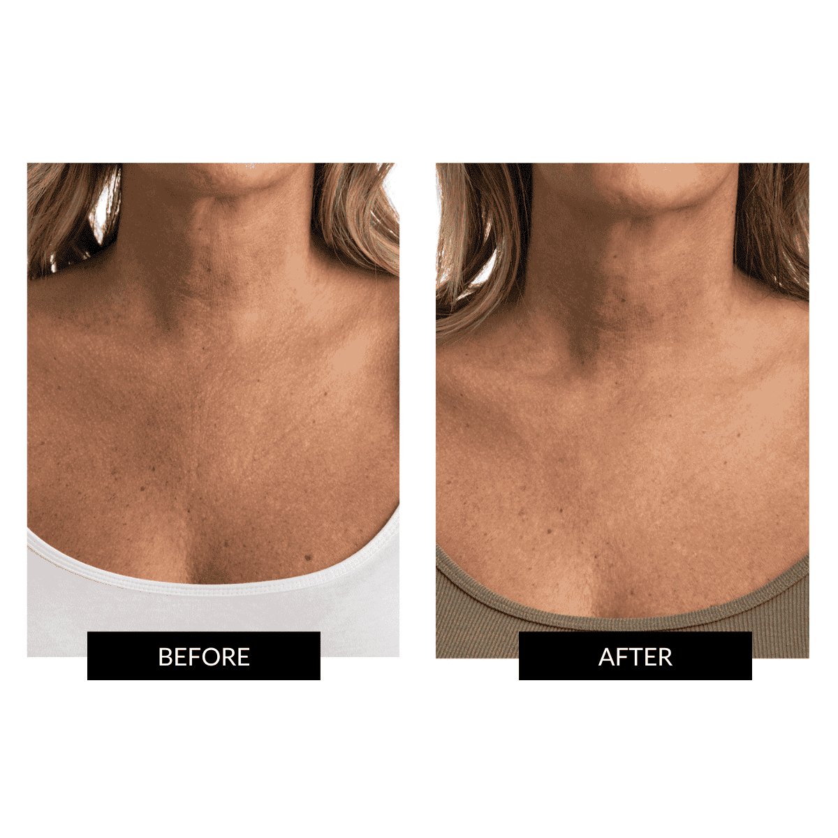 CurrentBody Skin LED Face & Neck Kit - Black Friday Offer - Image 6