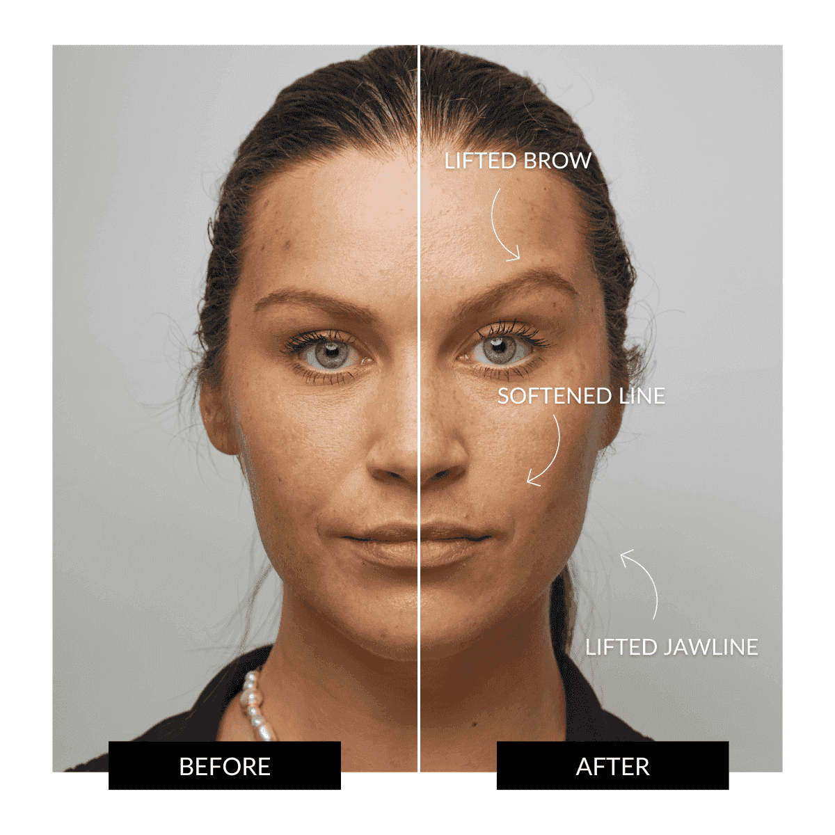 Offer - ZIIP HALO Nanocurrent Facial Toning Device - Image 8