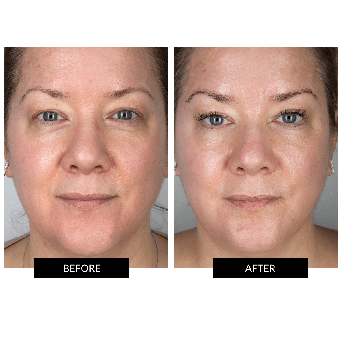 CurrentBody Skin Special LED Kit - Image 2