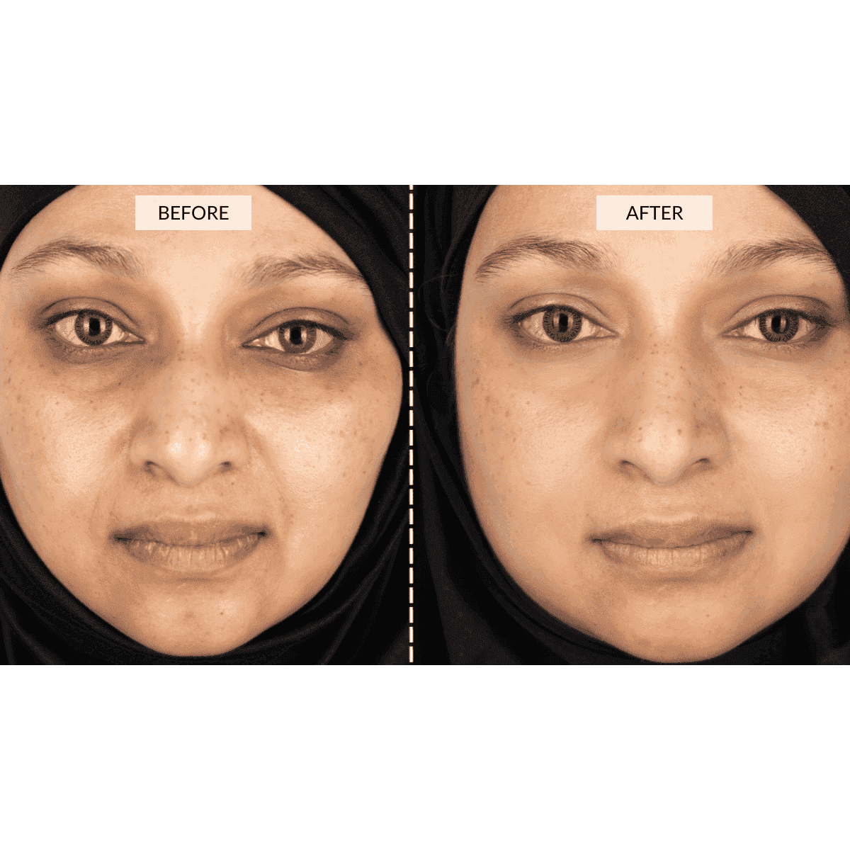 CurrentBody Skin LED Face & Neck Kit - Black Friday Offer - Image 4