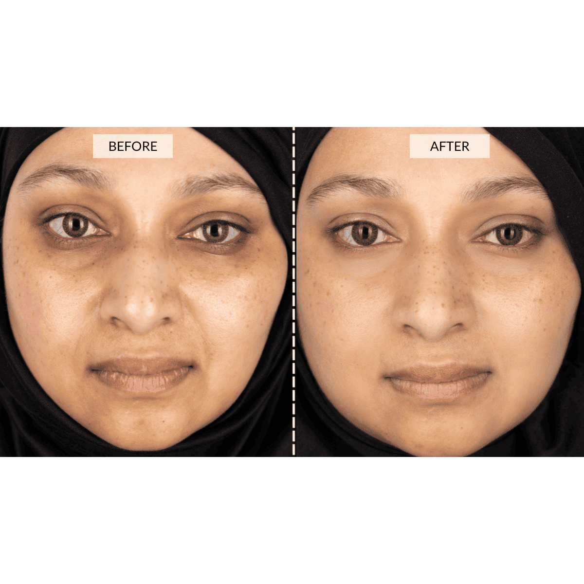 CurrentBody Skin – Silver Series 1 LED Mask Gift Set - Image 5