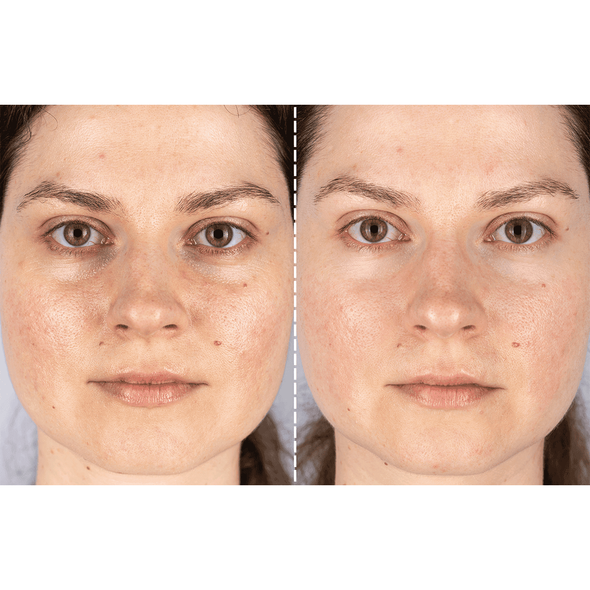 CurrentBody Skin X Peter Rabbit Limited Edition LED Light Therapy Mask - Image 5